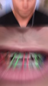 The real purpose of rubber bands might surprise you! 🤫🫣😳 #OrthoLove #BracesOff #SmileGoals #TeethTransformation | TheBentistofficial