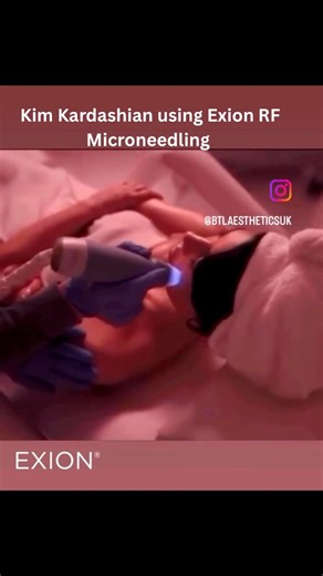 Even Kim Kardashian trusts Exion RF Microneedling — and now you can too. ✨ Level up your skin at IB Aesthetique & Wellness. ✨ Why clients love our Exion RF Microneedling • Instant glow long-term collagen boost • Smoother, tighter, firmer skin • Fades acne scars uneven texture • Minimal downtime, maximum results 📱For Inquiries and Bookings Call 619-490-3112 📍1555 Palm Ave Suite J-2 San Diego, CA 92154 For Online Booking, visit our website 🌐 www.ibaesthetique.com #medspa #sandiegomedspa #chulav