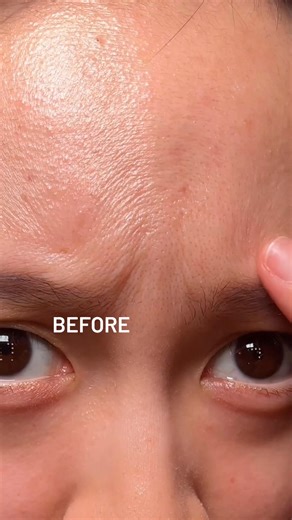 ✨ Transform Your Skin in Just 48 Hours! ✨ Boost collagen by 63% with our advanced trans-epidermal delivery system—peptides, neurotransmitters, and botanical lift actives work together to mimic microneedling results. | Dr. BRANDT Skincare