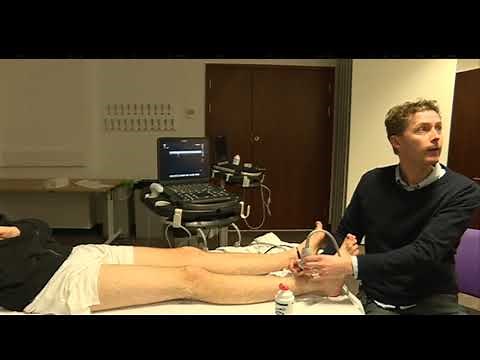 Tutorial - ultrasound guided ankle block - Dr Nat Haslam