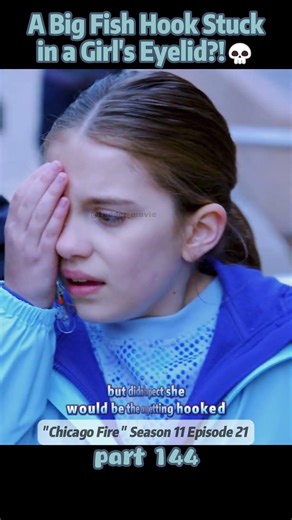A Big Fish Hook Stuck in a Girl’s Eyelid?!💀【Part 144】