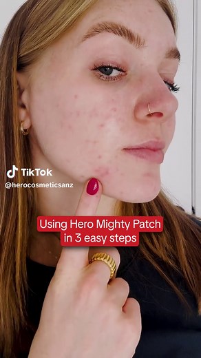 Here are 3 EASY steps in using the Hero Mighty Patch. 1. Clean with micellar water 💧 2. Dry area 🌬️ 3. Stick your Hero Mighty Patch ❤️ You’re welcome 💋 Sincerely yours, your skincare bestie #lifehack #pimplehack #skincarehack #herocosmetics #herocosmeticsanz #heromightypatch #themightypatch #pimplepatch #pimple #pimples #pimplepopper #pimplesolution #pimpletips #pimplelife #acne #skincare #skincarecommunity #skincareaddict #skincarejunkie #chemistwarehouse #woolworths