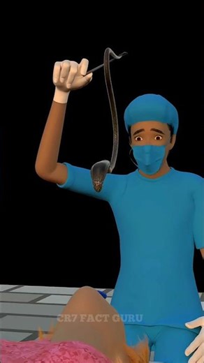 A snake entered the girl's stomach 🐉 #shorts #shortvideo