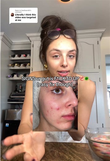 Understanding Gut Health Symptoms and Simple Solutions