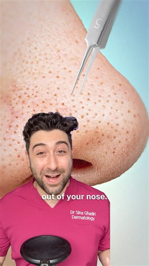 How to REMOVE blackheads from nose at HOME