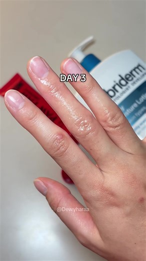 Guys, It really works! 7 Days of footage saying goodbye to dry, sensitive hand eczema with @LUBRIDERM® pawpaw ointment. #eczema #eczemarelief #dryhands #lubriderm #handmoisturizer