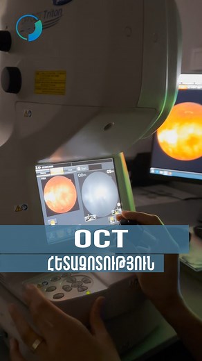 74 reactions | OCT(Optical Coherence Tomography) հետազոտությունը ոչ...