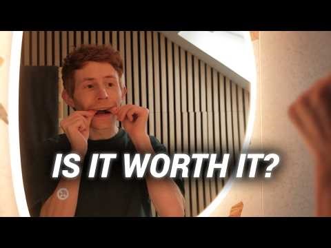 Things I Wish I'd Known Before Getting Invisalign