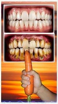 The Perfect Tooth Brushing Routine: A Guide to a Healthier Smile #shorts #healthysmile