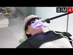 Paso a paso blanqueamiento Power Bleaching