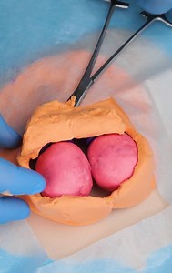 1.1M views · 599 reactions | Medical Extractions, Explained #fblifestyle | Crafty Gadgets | Facebook