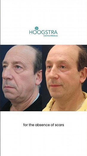 Hoogstra - Tratamientos con la última tecnología - R24020