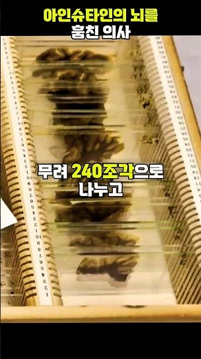 아인슈타인의 뇌를 훔쳐 조각낸 의사