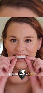 19 reactions | Wow! Check out this amazing transformation with our custom designed veneers! From before to after, we're completely blown away by the results #veneers #incredibilveneers #brighterimagelab #beforeandafter #beforeafter #newsmile #newsmilenewlife #gappedteeth #whiteteeth #nodentists #smilemakeover #smiletransformation #smiledesign | Press On Veneers by Brighter Image Lab | Facebook