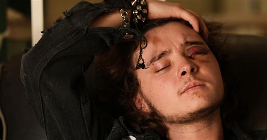 Demonstrator injured after federal agent fired projectile during California protest