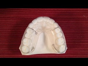 Hybretain Orthodontic Retainers