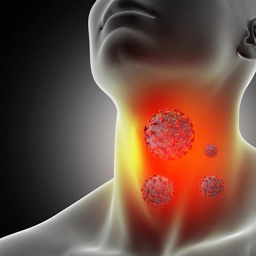 Symptoms of Esophagus Cancer ‪@DrAshishSachan‬