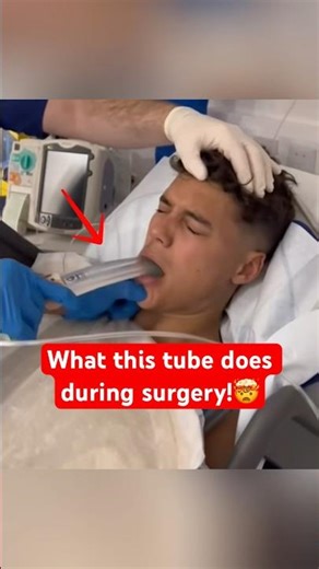 Why Doctors Put This Tube In Your Throat During Anesthesia