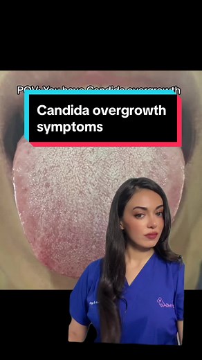 Understanding Candida Overgrowth Symptoms: Causes and Solutions