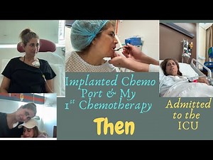 Implanted Chemo Port & 1 Chemotherapy