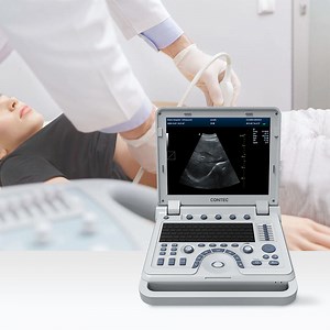 [Hot Item] Contec Cms1700b China Color Doppler Medica Portable Scanner Ultrasonic Medical Ultrasound Machine