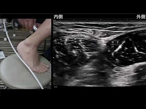 足の外科医のエコー講座第2回特典動画 足の健のエコー解剖