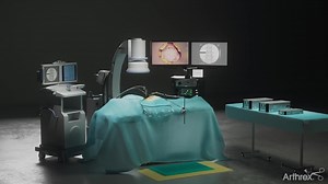 Arthrex Ultra-Minimally Invasive Spine Portfolio Overview
