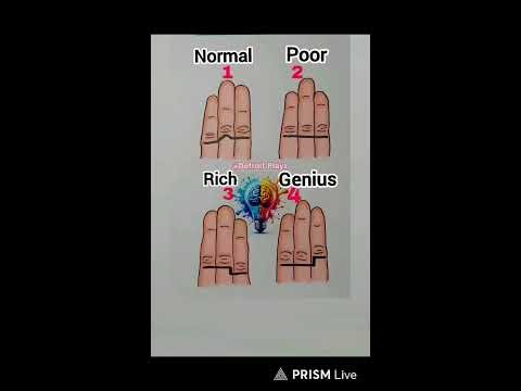 😵🧠WHAT IS YOUR STATUS 🧠😵