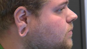 Man regrets stretched earlobes, gets surgery