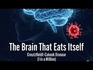 The Rare Brain Disease That Eats Itself: Creutzfeldt-Jakob Disease
