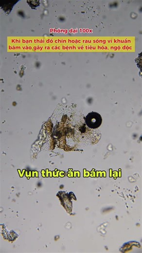 Thớt nhà ai đâyyy #kinhhienvi #education #microscope #thớt
