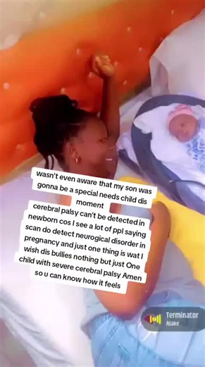 Understanding Cerebral Palsy in Babies