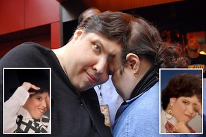World’s oldest conjoined twins, Lori and George Schappell, dead at 62