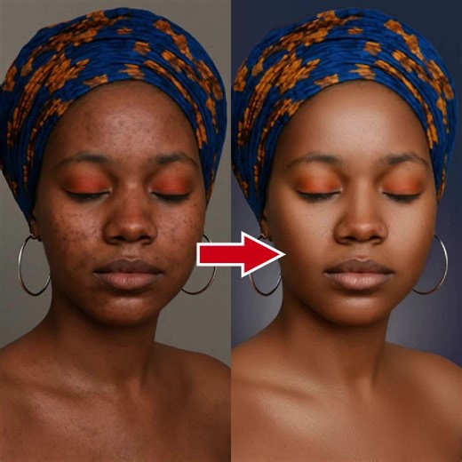 🎯 Want flawless, smooth skin in your photos? Learn how to master Frequency Separation in Photoshop! Perfect for beginners. 🙌 Comment interested to get the full tutorial! ✨ #SkinRetouching #PhotoshopTips #FrequencySeparation #EditingHacks #PhotoshopMagic