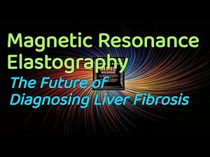 Magnetic Resonance Elastography: The Future of Diagnosing Liver Fibrosis