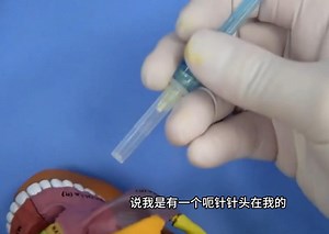 儿牙治疗中STA辅助牙周膜注射实操讲解