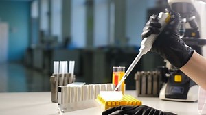 Laboratory test plate. Female researcher pipetts samples in well microplate. medical test of blood or dna. test of cancer or virus. Scientist researching in laboratory. Pandemic danger. 4 k video