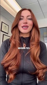 Myths About Hyaluronic Acid Filler: Filler Migrates #shorts #filler