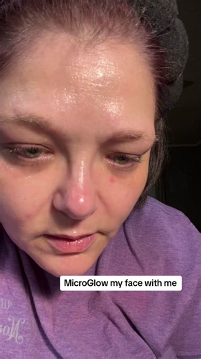 @microglowlifting Called the MicroGlow Intense pulsed light wrinkle reducing instrument. ES-1081 I’ve had this for almost 2 years.