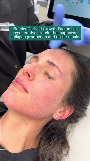 PDGF after Skin Laser Treatments
