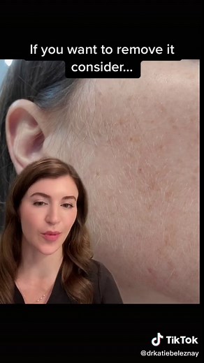 Understanding Peach Fuzz: Tips from a Dermatologist