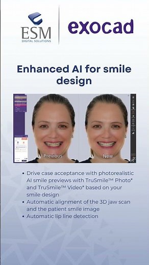 🚀 Introducing Exocad DentalCAD 3.3 Chemnitz