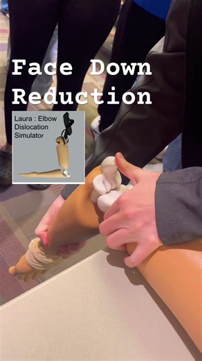 Elbow Dislocation : how to reduce alone! #orthopedic #sportsmedicine