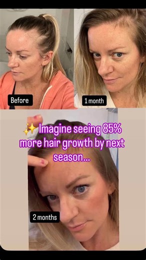 ✨ Ready for thicker, stronger, healthier hair? ✨ The Densify Shampoo...