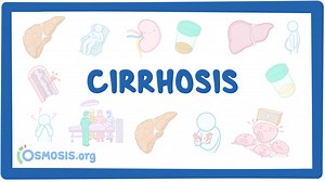 Cirrhosis: Video & Meaning | Osmosis