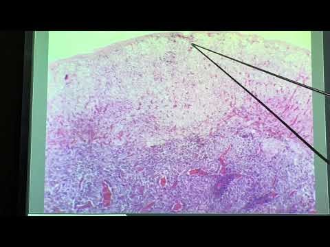 BIOL 158 Adrenal Gland Slide