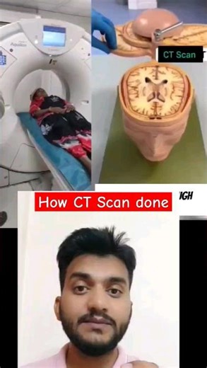 CT scan kya hota hai #how ct scan done #head injury #shorts #viral #illness #medical