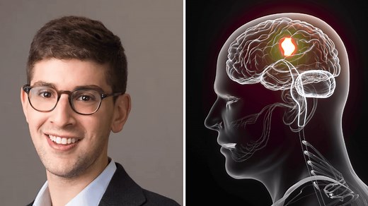 Neurologist reveals 10 warning signs to look for if you care about your brain
