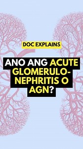 Ano ang Acute Glomerulonephritis o AGN? | Dr. Carlo Trinidad - Kidney MD