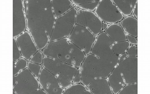 【实验方法】 用µ-Slide Angiogenesis做血管生成实验